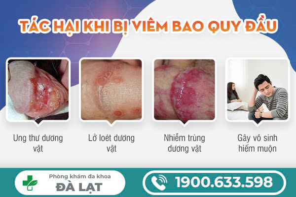 Hình ảnh minh họa